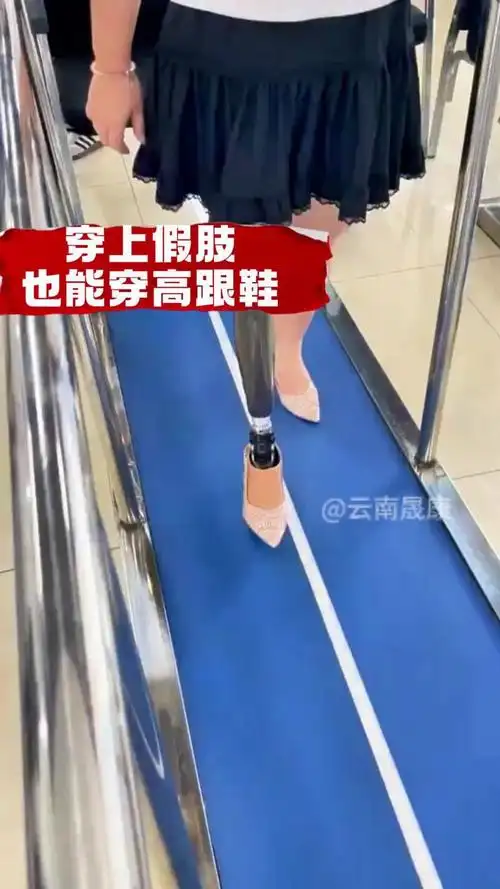 云南晟康假肢安装公司,假肢康复训练机构!