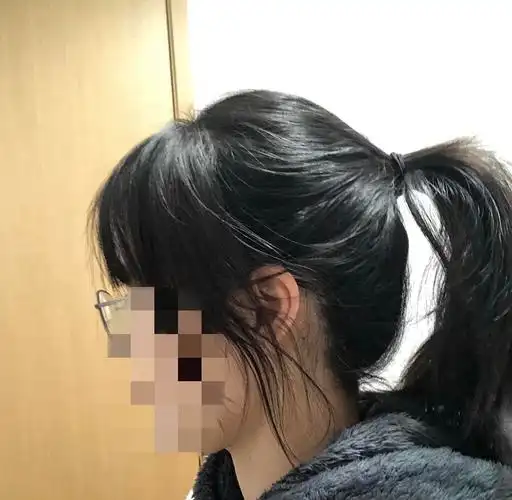 友友们我这头到底是尖的问题还是扁的问题