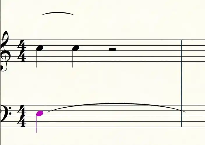 finale2011 的同音连线显示不对劲 如图