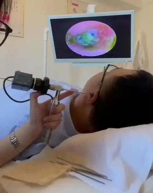 阿昌无线可视采耳设备手把镜高清采耳镜软管镜大屏幕可视采耳工具-阿