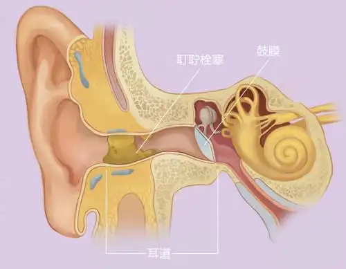 长期以往就形成了耵聍栓塞,耵聍栓塞阻隔到外界的声音,传不到鼓膜位置