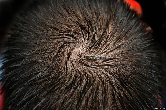 头上的"旋"是什么意思?是不是跟智力?看到这里我就知道了