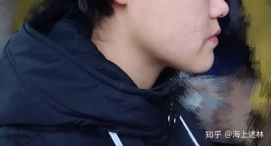 我这样的算下颌骨大吗?