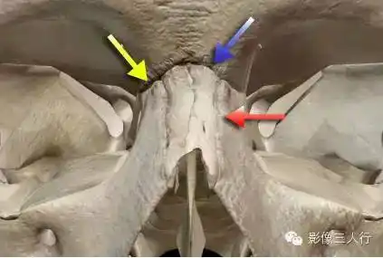 下图:鼻额缝(蓝箭),鼻上颌缝(红箭),额颌缝(黄箭)鼻骨孔:鼻骨的中间有