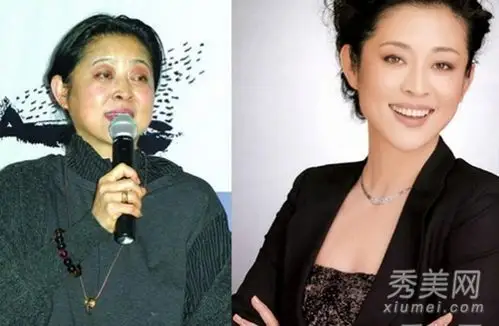 刘翔老婆葛天整容? 9位女星大方承认整形