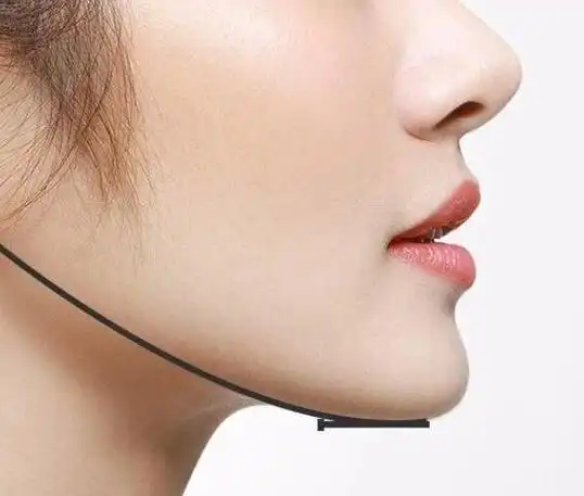 下颚线是什么意思