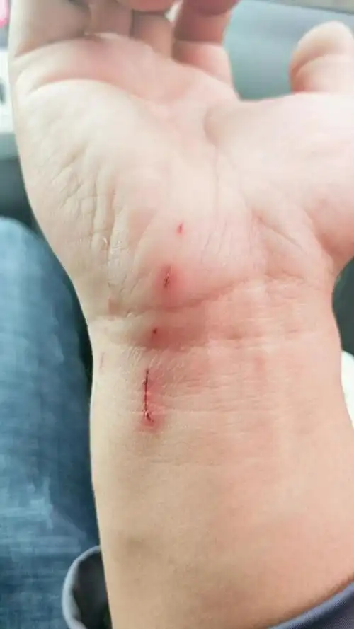 救一只喵星人被抓伤了而且伤口蛮深的需不需要打针阿?