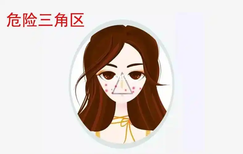 把脸部危险三角区的痘痘抠烂了怎么办?