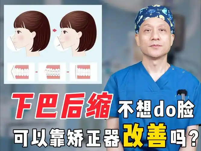 下巴后缩可以靠矫正器改善吗?