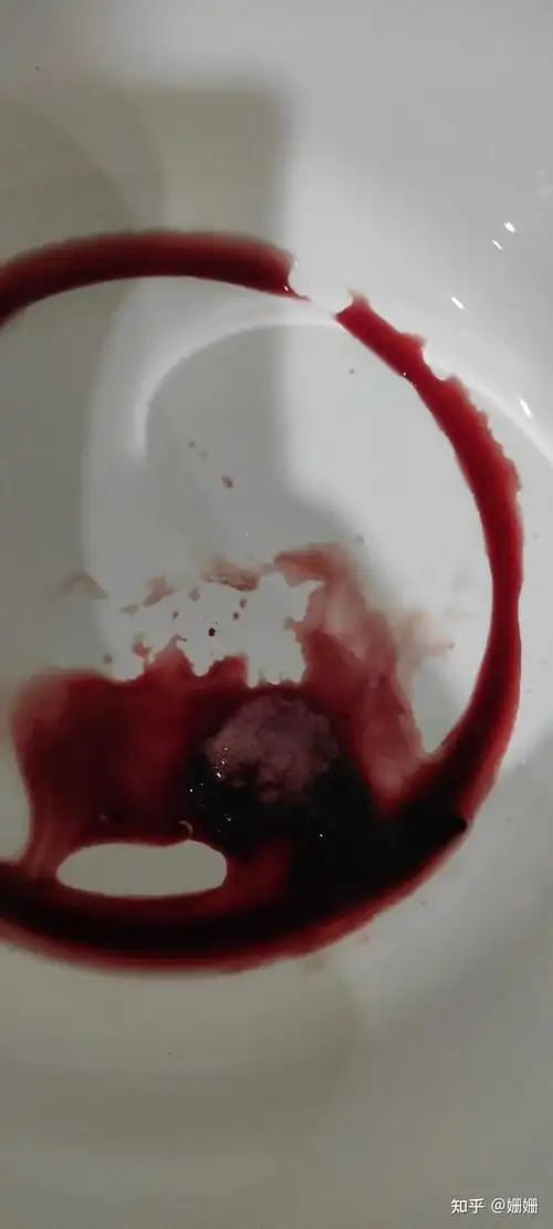 第二次药流清宫经历