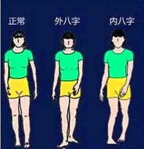 外八字走路是什么样的 外八字走路的人有什么特征-神机妙算网