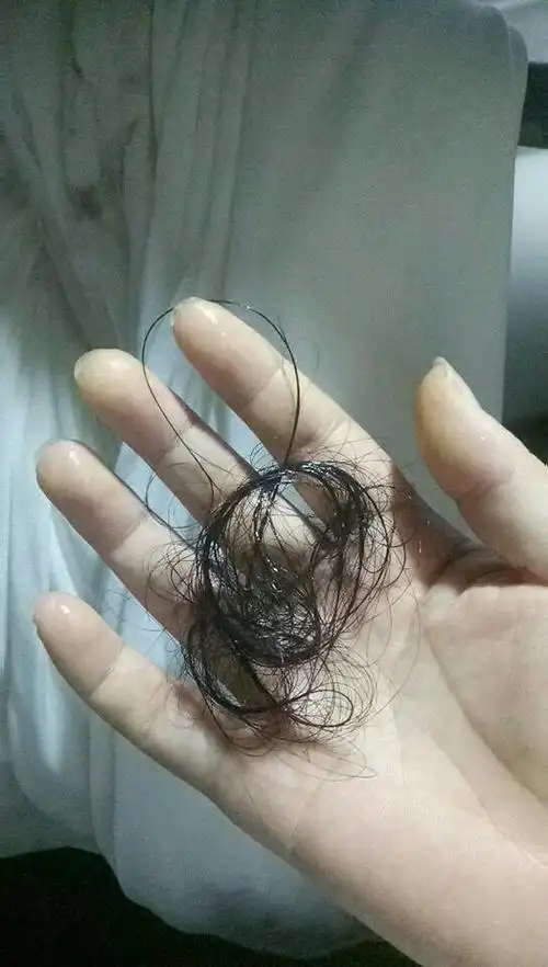 最近几个月老掉头发,从根部掉,掉好多怎么办