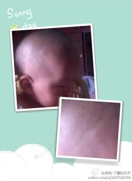 我家宝宝八个月,头两