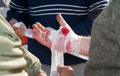 干货!专家传授紧急止血方法