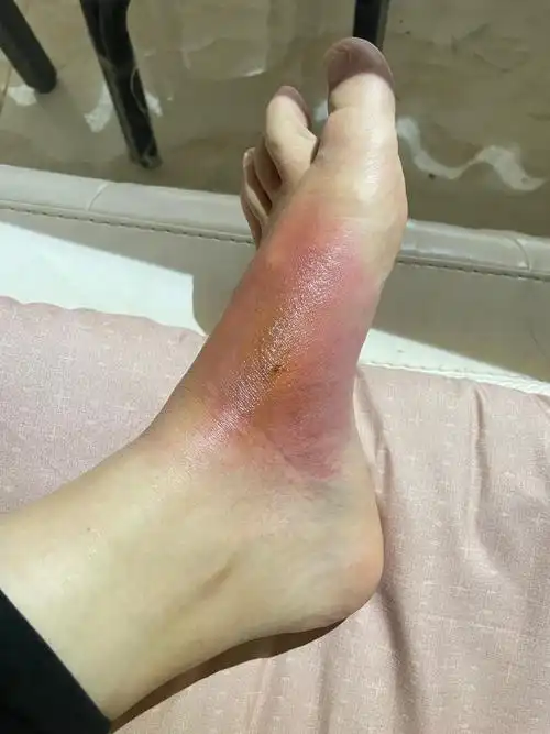 是好转的迹象,既难受又开心.