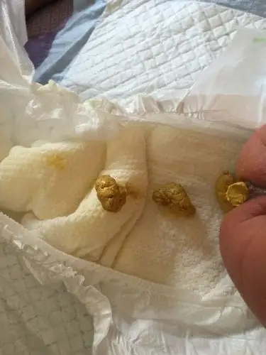 宝宝纯奶粉喂养,大便干硬粗,每次拉不出都哭闹