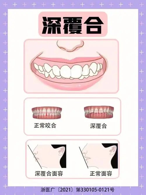 形成因素!矫正方式