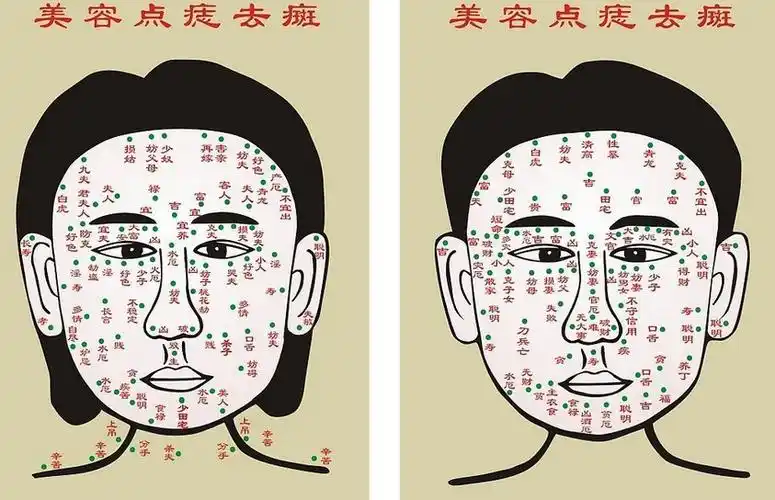 点痣图解