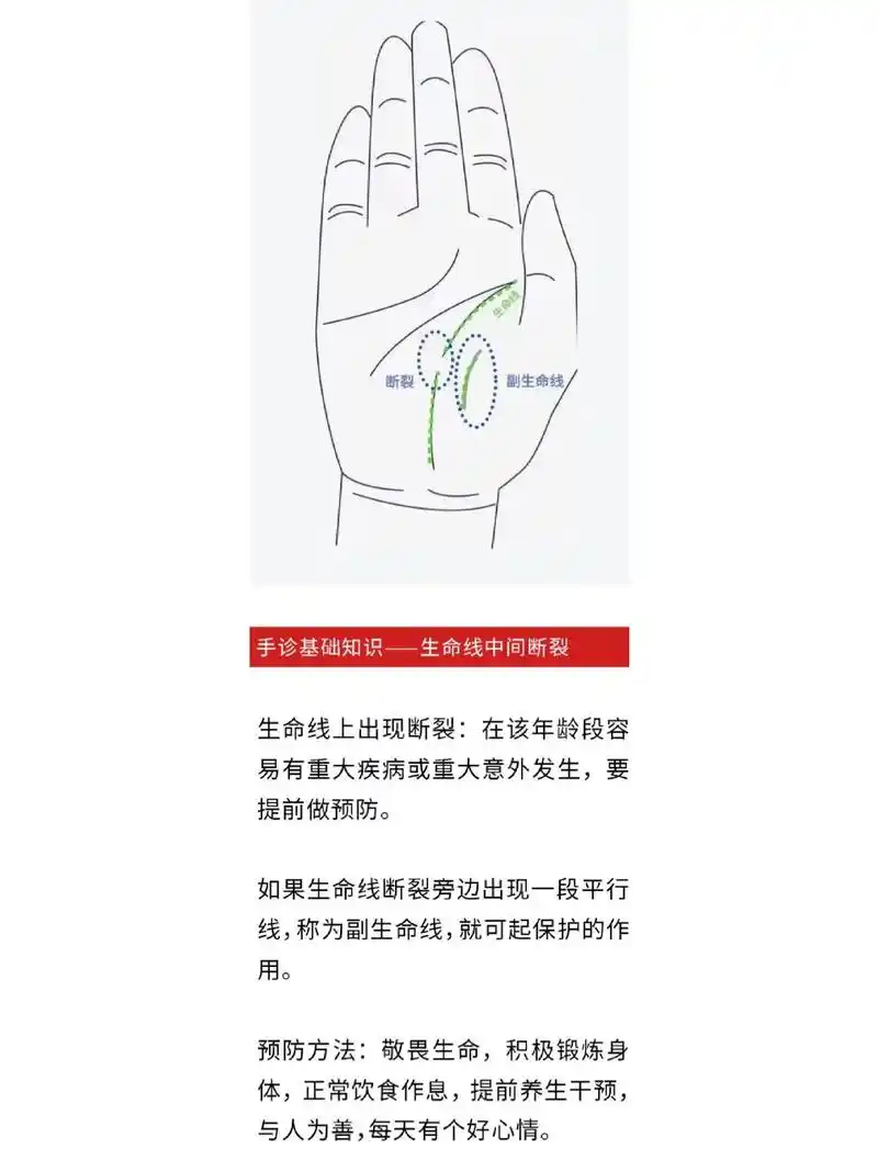 手诊基础知识——生命线中间断裂 手诊基础知识——生命线中间断裂