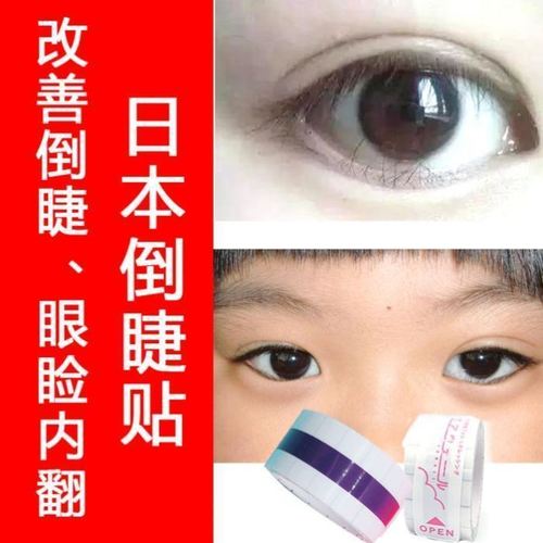 正防过敏下垂眼贴原装胶布娇倒睫贴胶带改善眼睑睑外翻脱敏小学生