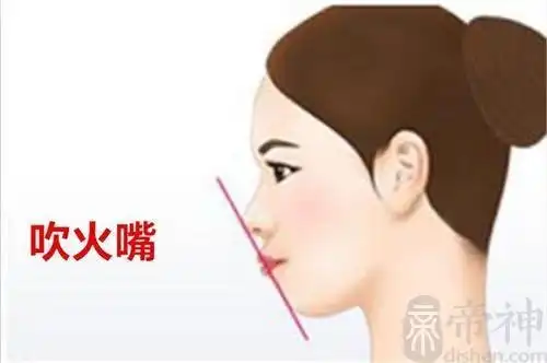 吹火嘴图片解析吹火嘴是好面相吗