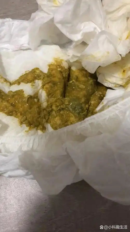 宝宝拉肚子,黄色粘液便 求助!