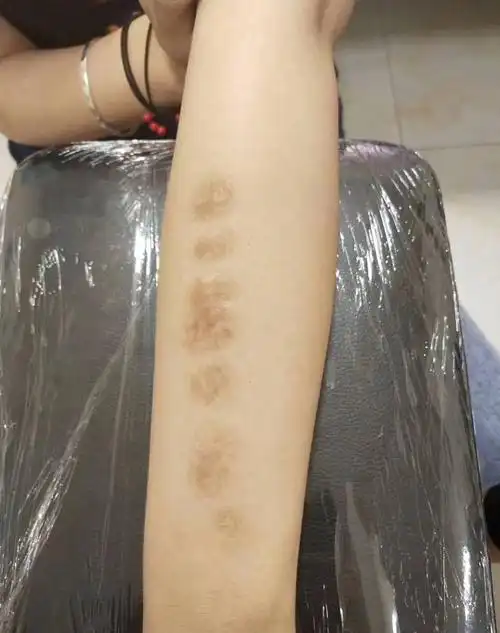 遮盖烟疤纹身图片手臂纹身图案