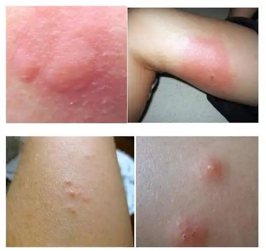 红火蚁入侵四川48个县市区?华西专家说,爱送你包包的虫虫才不止这些