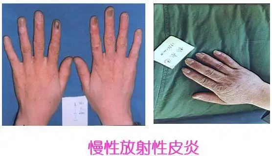 大连机场查出某旅客佩戴生命能量石核辐射超标112倍常