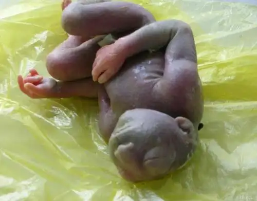 【图片】自己拍的无脑儿的图片