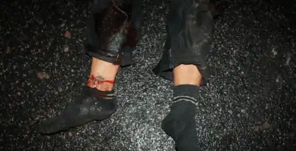 云南道路上现一具男尸体,脸已看不清,警方通报来了|交通事故|车祸