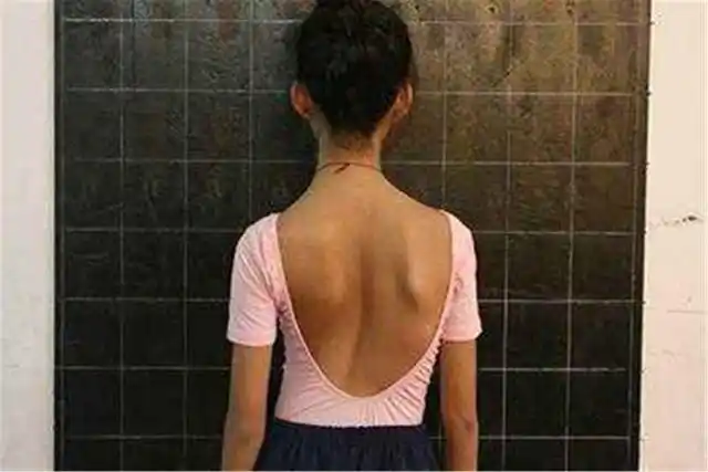 68%的儿童脊柱有问题,与父母不当护理有关,不及时纠正影响发育|驼背