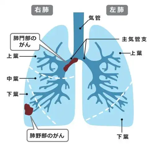 当前位置:>首页>资讯动态>健康资讯>小细胞肺癌有治愈的可能吗?
