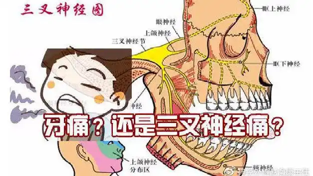 莫贪凉小心空调吹出三叉神经痛