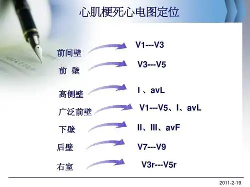 急性心肌梗死心电图梗死相关血管定位诊断ppt 心肌梗死心电图定位 v1