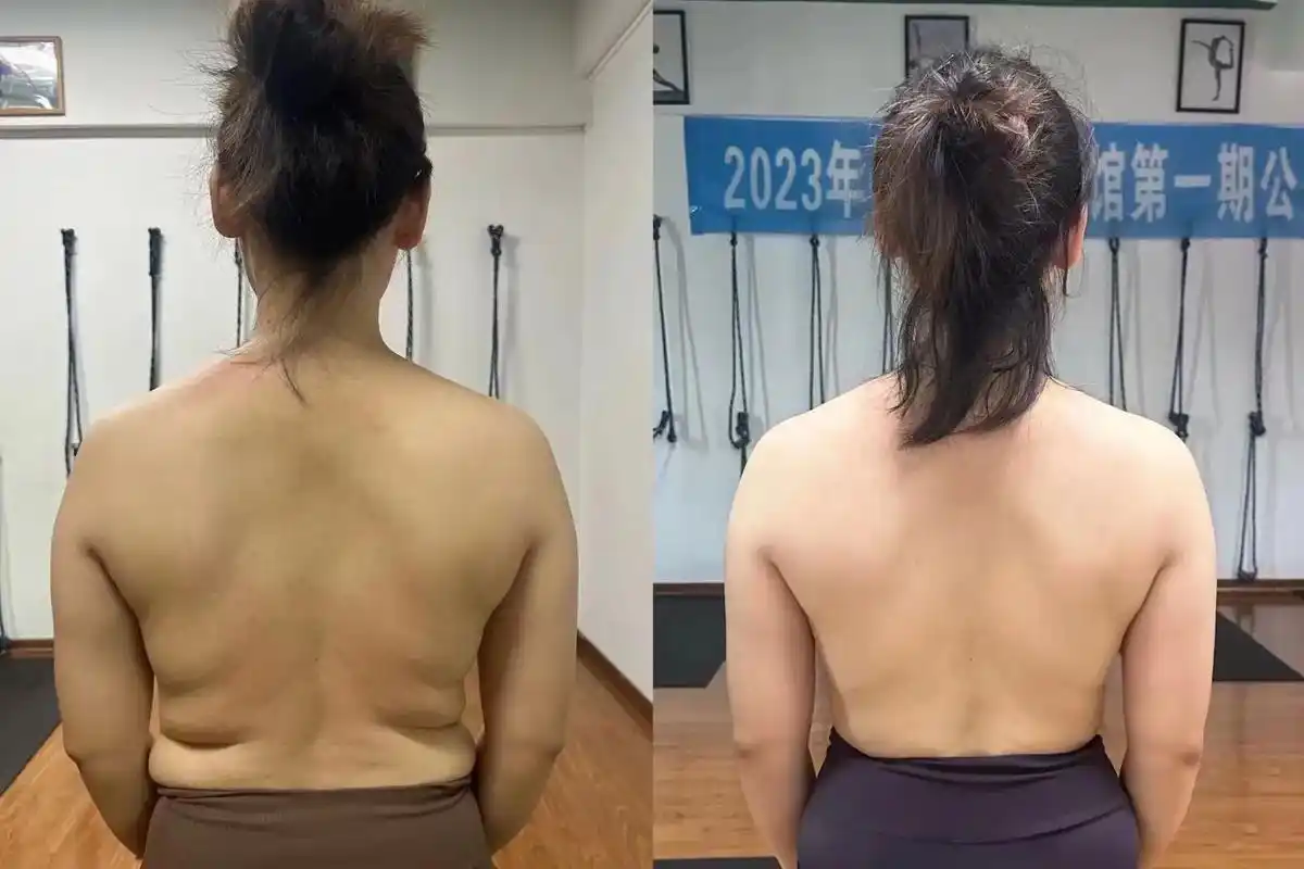 【产后身材走样】产后很多妈妈陷入身材焦虑,盲目想快速减肥, - 抖音