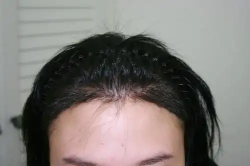 女人发际线m型的面相表示着什么还有哪些发际线面相