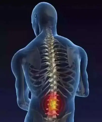 腰间盘突出症怎么办?如何治疗?  田惠林教授来帮您