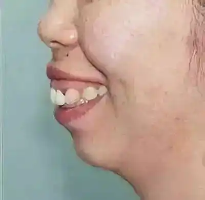 "地包天"和"天包地"面相,命运有什么不同_地球_生活_女人