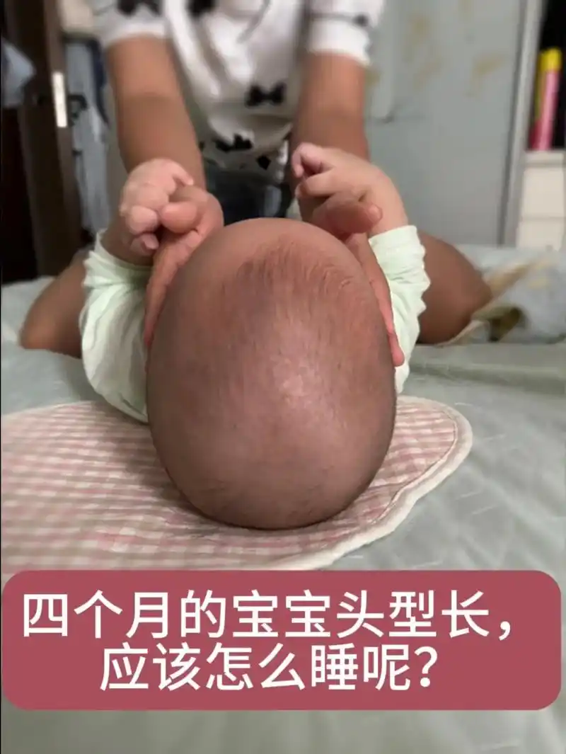 宝宝后脑勺凸,不喜欢仰睡,有什么好办法?如果是不喜欢仰睡的宝 - 抖音