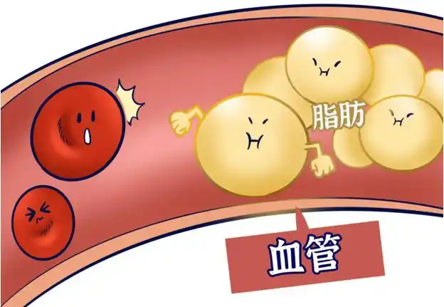 冬季预防高血脂的方法-中医养生-人参牛骨髓鱼胶原蛋白牡蛎复合肽