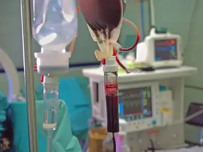 在手术输血照片