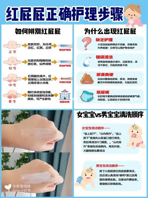 红屁股_护臀膏_清洁_拜耳怎么样_贝乐怎么样_宝宝红屁屁大作战_母婴