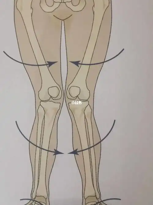 当臀肌无力时,可能会导致髋关节出现过度内收和内旋,膝关节就会相应往