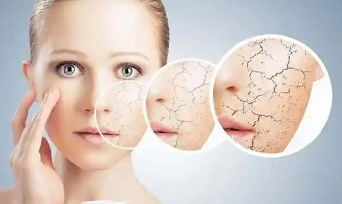皮肤缺水怎么办这6个补水技巧教你改变