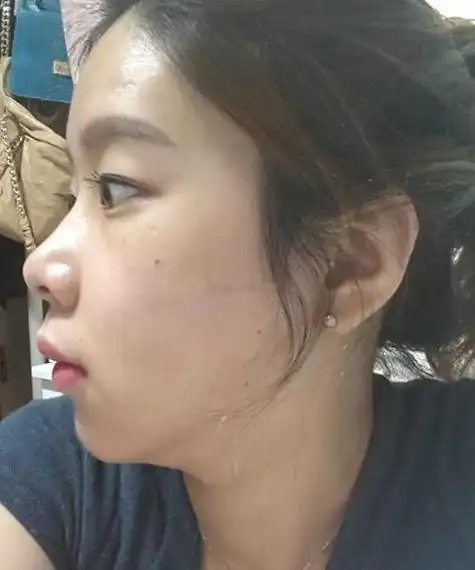 地包天到底多么可怕